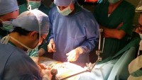 Suriye’de İlk Karaciğer Nakli Ameliyatı Başarılı Oldu