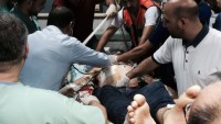 Kudüs’teki Çatışmalarda Filistinli Bir Genç Başından Ağır Yaralandı