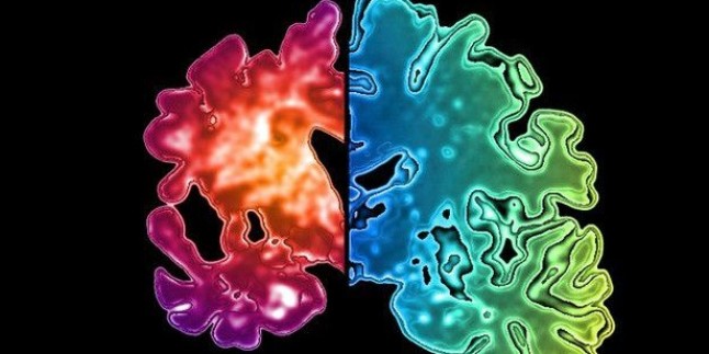 Alzheimer’ı yavaşlatabilecek ilaç açıklanıyor