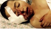 İsrail askerlerinin ateş açması sonucu 5 yaşındaki çocuk yaralandı