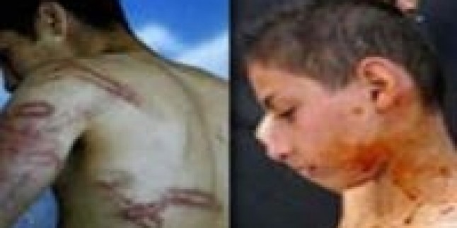 Siyonist İsrail zindanlarındaki Filistinli çocuklara işkence ediliyor