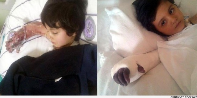 Yozgat’ta Hastaneye Karın Ağrısı Şikayetiyle Giden 4 Yaşındaki Çocuk Kangren Oldu…