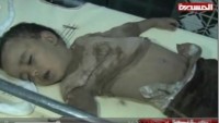 Video: Yemen’e Yapılan Hain Saldırıdan Görüntüler
