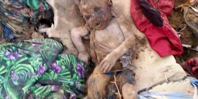 Foto: Siyonist Suud Uçakları, Mazlum Yemenli Çocukları Kimyasal Bombalarla Katlediyor