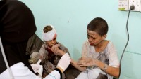 Suudilerin Saldırısında 3.500’den Fazla Yemenli Çocuk Şehit Oldu