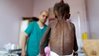 Yemen’de Her 11 Dakikada Bir Çocuk Ölüyor