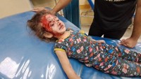 Batı medyası Gazze savaşında zalimin yanında