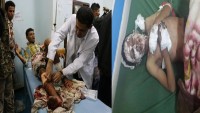 Siyonist Suudi Rejimi Yemen Halkına Yönelik Saldırısını Sürdürüyor: 37 Şehid