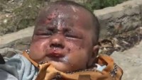 Savaş Yemenli çocuklar üzerinde önemli tahribat bırakıyor