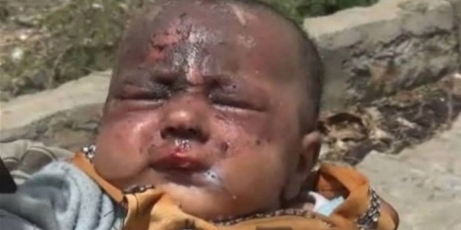 Savaş Yemenli çocuklar üzerinde önemli tahribat bırakıyor