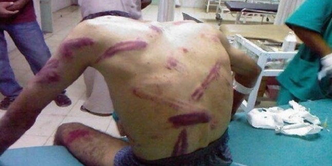Bahreyn zindanlarında tutuklulara yönelik ağır işkence sürüyor