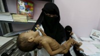 Yemen’de kolera salgınından ölenlerin sayısı 1300’e yükseldi