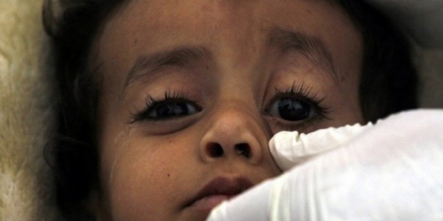 Yemen’de kolera can almaya devam ediyor