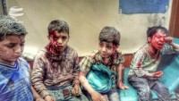 Yemen’de bu yıl çocuk ölümünün 50 bine yükseleceği tahmin ediliyor