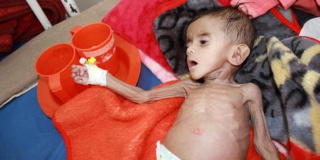 Kızılhaç uyardı: Yemen açlıktan ölmek üzere