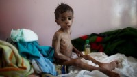 Yemen’de su ve hastalıktan en az 2 bin kişi öldü