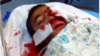 Kudüs’ün Şa’fat kampından bir çocuk gözünden ağır yaralandı