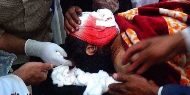Suudi Savaş Uçakları, Yemen Halkını Vahşice Bombaladı