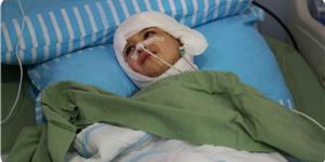 Siyonist Zalim Rejim, Yaktığı Çocuğun Hastane Masraflarını da Ödemedi