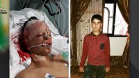 Siyonist İsrail Askerlerinin Kurşunlarıyla Yaralanan Filistinli Çocuk Bu Sabah Şehit Oldu