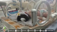 Arap İnsan Hakları Örgütü: Gazze’de Hastaların Ölmesinden Abbas Sorumlu