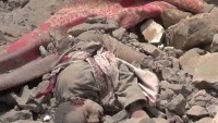 Siyonist Suud Ordusunun Yemen Halkını Katliamı Sürüyor: 9 Şehid