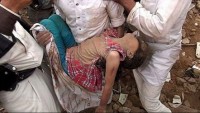 Suudi uçakları Yemen’de otel vurdu: 35 Şehid, 25 Yaralı