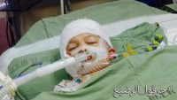 Foto: YakÄ±larak ÅŸehid edilen Filistinli bebeÄŸin abisi de hastanede tedavi gÃ¶rÃ¼yor