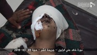 Suud Güçleri Yemende Kadın Ve Çocukları Hedef Aldı: 22 Ölü