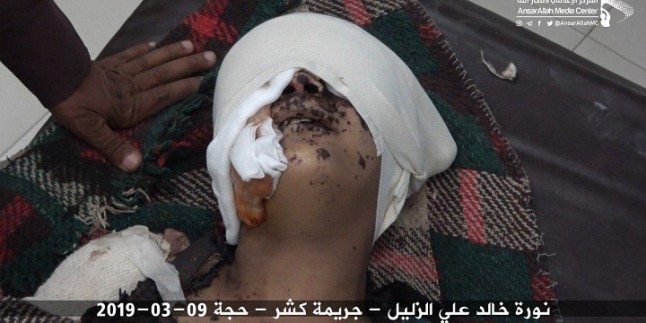 Suud Güçleri Yemende Kadın Ve Çocukları Hedef Aldı: 22 Ölü