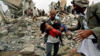 Spiegel: Dünya Yemen’de İnsan Eliyle Yapılan Faciayı İnkar Ediyor