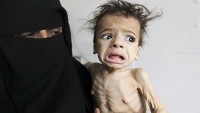 ABD’li senatör: 85 bin Yemen’li çocuk açlıktan öldü