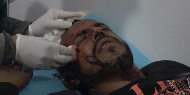 Siyonist Suudi Savaş Uçakları Yemen Halkını Bombaladı: 9 Şehid, 12 Yaralı