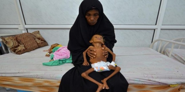 Yemen Sağlık Bakanlığı: 4 binden fazla Yemenli hastanın hayatı tehlikede